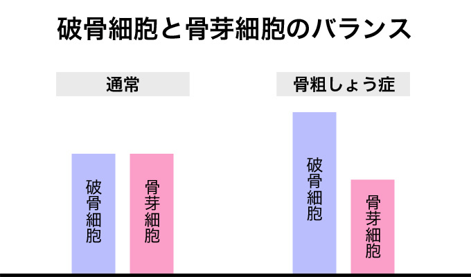 破骨細胞と骨芽細胞のバランス